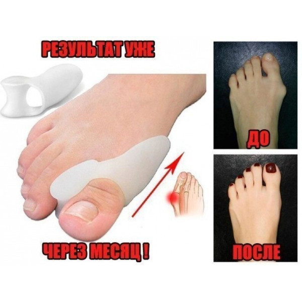 Фіксатор для корекції кісточки великого пальця ноги valgus pro