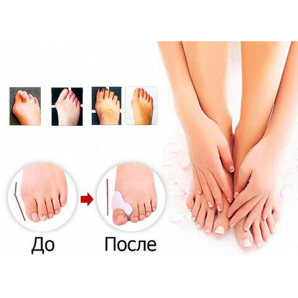 Фіксатор для корекції кісточки великого пальця ноги valgus pro