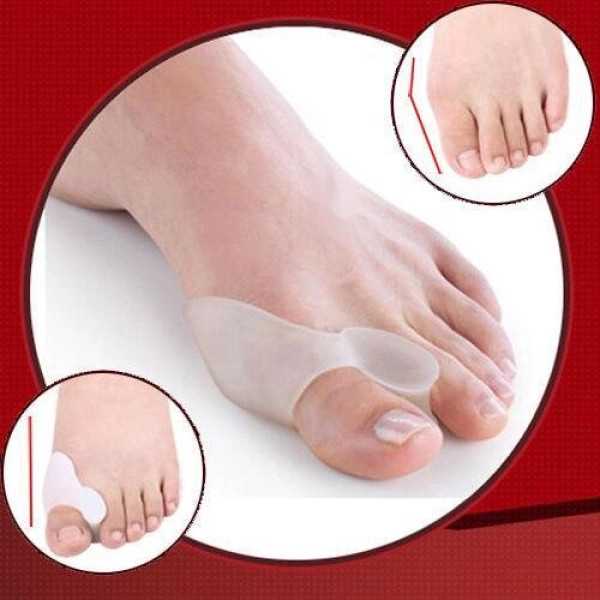 Фіксатор для корекції кісточки великого пальця ноги valgus pro