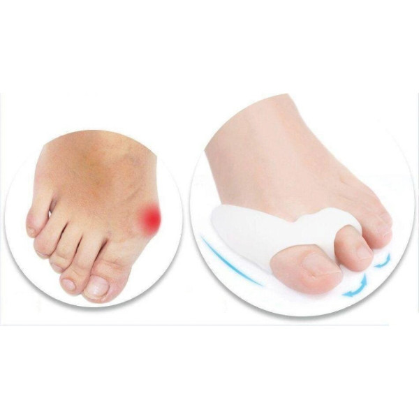 Денний фіксатор великого пальця ноги valgus pro
