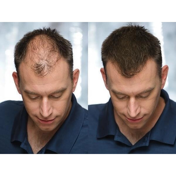 Загущувач для волосся toppik hair building fibers колір чорний